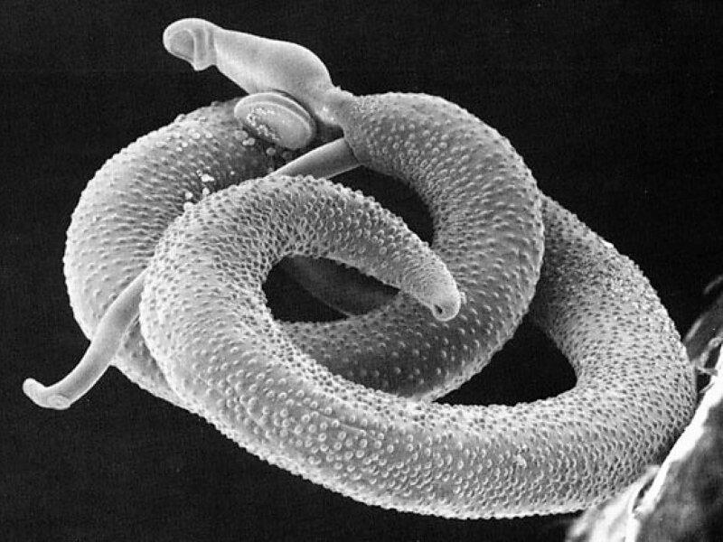 Шистосомы - те самые микроскопические паразиты. Фото из Википедии.